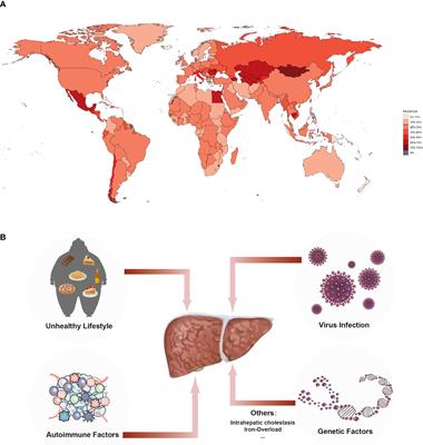 Immune microenvironment changes of liver cirrhosis: emerging role of mesenchymal stromal cells